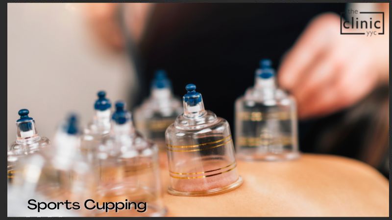 Sports Cupping